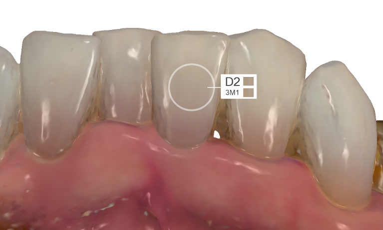 Trios Scanner Shade Measurement