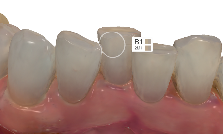 Trios Scanner Shade Measurement